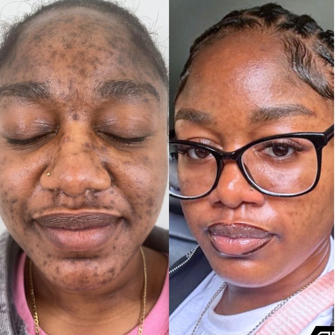 GAMME ANTI-AGE SELLIUM™